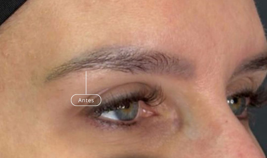Antes
