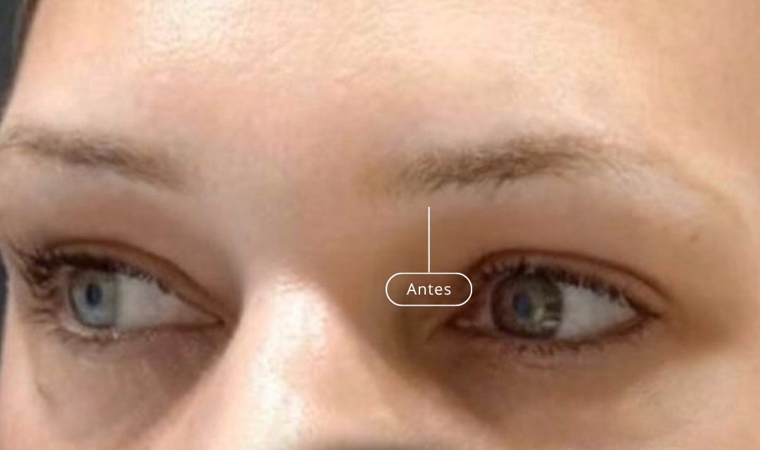 Antes